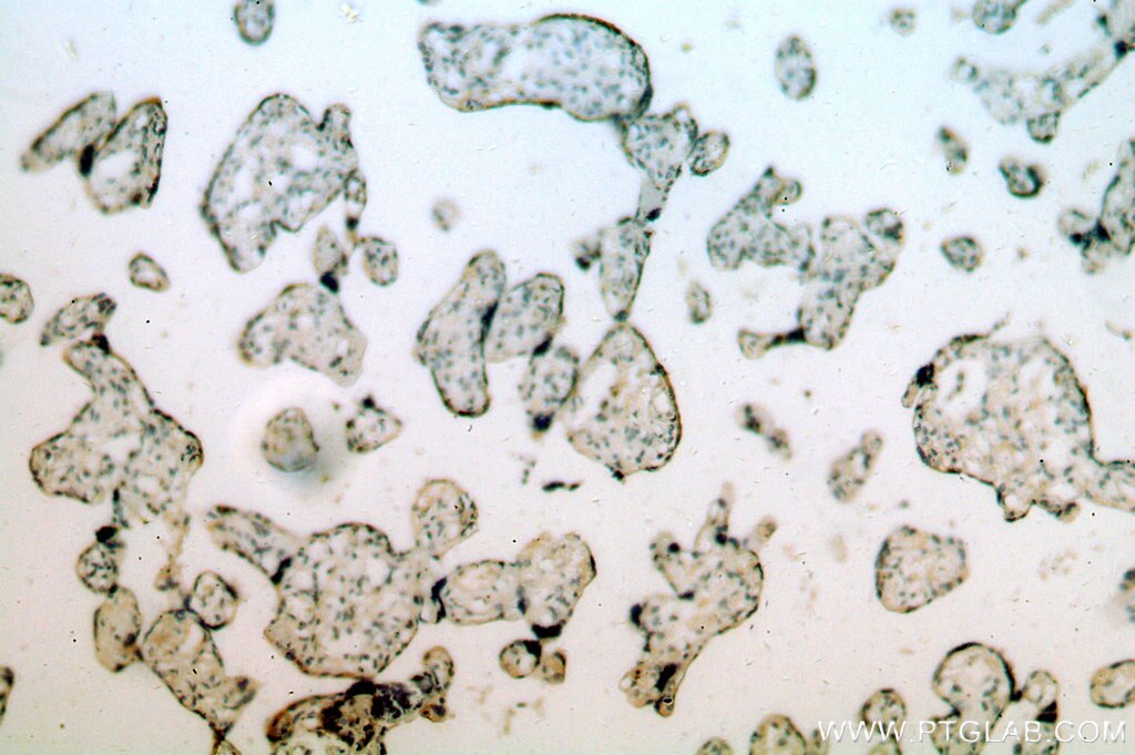 SLC18A1 IHC Immunohistochemical 20340-1-AP SLC18A1 Antibody CGAT; VAT1; VMAT1