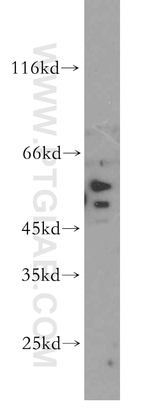 SLC18A1 western blot WB 20340-1-AP SLC18A1 Antibody CGAT; VAT1; VMAT1