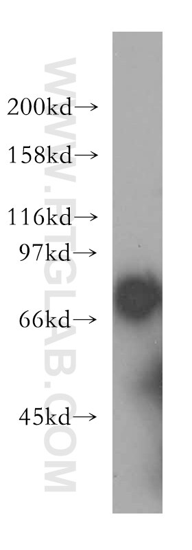 COLO 320 cells were subjected to SDS PAGE followed by western blot with 12820-1-AP(SLC20A2 Antibody) at dilution of 1:1000 SLC20A2 western blot WB 12820-1-AP SLC20A2 Antibody GLVR2; Glvr-2; MLVAR; PIT-2