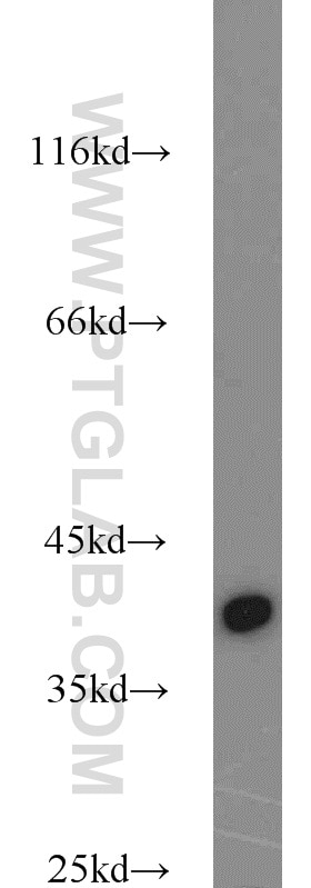 URAT1 western blot WB 14937-1-AP URAT1 Antibody OAT4L; RST; URAT1