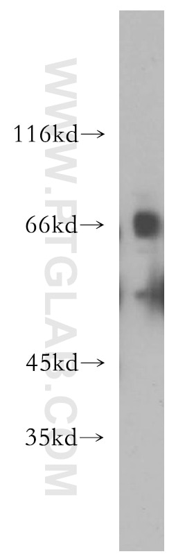 mouse kidney tissue were subjected to SDS PAGE followed by western blot with 13594-1-AP(SLC22A2 Antibody) at dilution of 1:800 SLC22A2 western blot WB 13594-1-AP SLC22A2 Antibody MGC32628; OCT2