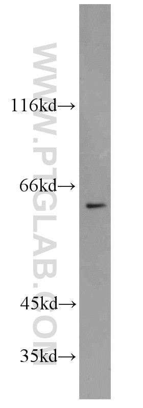 Raji cells were subjected to SDS PAGE followed by western blot with 10789-1-AP(SLC25A13 Antibody) at dilution of 1:800 SLC25A13 western blot WB 10789-1-AP SLC25A13 Antibody ARALAR2; CITRIN; CTLN2