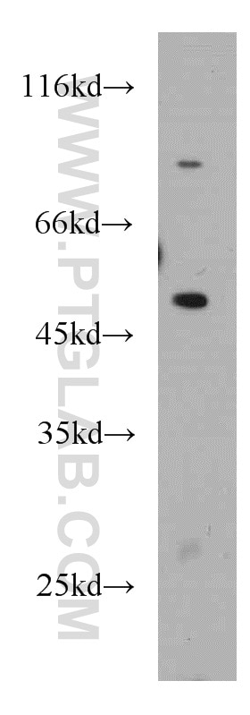 RAW 264.7 cells were subjected to SDS PAGE followed by western blot with 21568-1-AP(SLC25A25 Antibody) at dilution of 1:800 SLC25A25 western blot WB 21568-1-AP SLC25A25 Antibody KIAA1896; MCSC; MGC105138; MGC119514; MGC119515; MGC119516; MGC119517; PCSCL; RP11-395P17.4; SCAMC-2