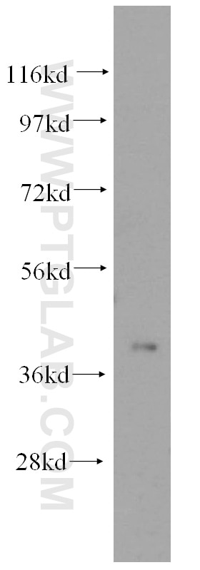 SLC25A3 western blot WB 15855-1-AP SLC25A3 Antibody OK/SW-cl.48; PHC