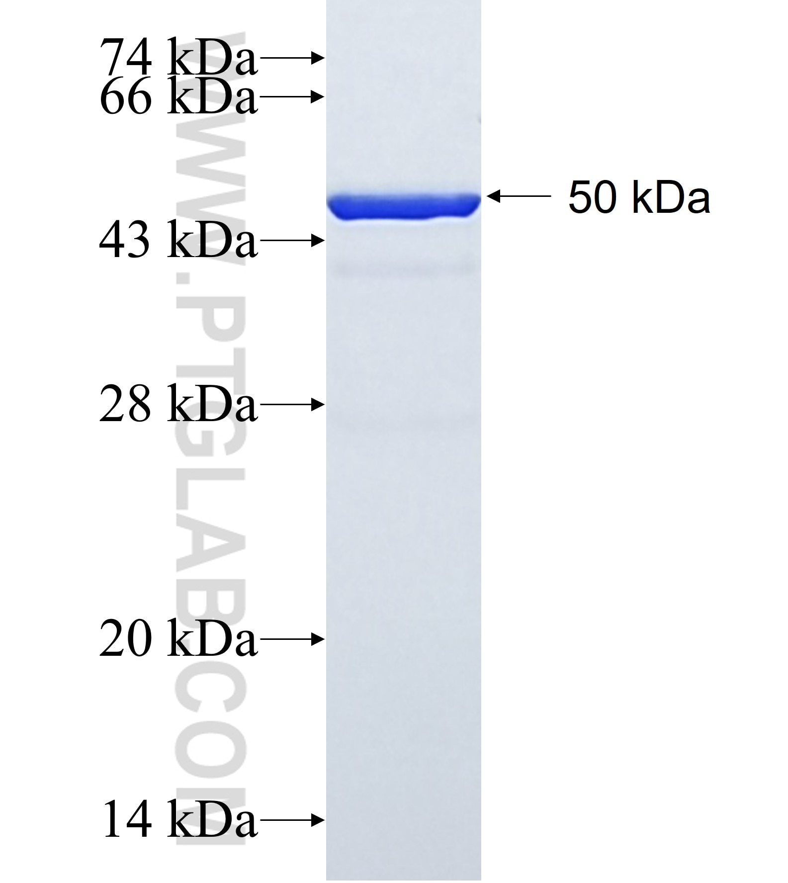 SLC27A4 fusion protein ag1490 SDS-PAGE