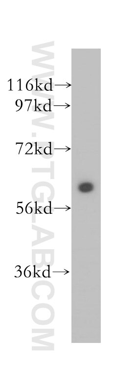 human brain tissue were subjected to SDS PAGE followed by western blot with 12039-1-AP(SLC38A1 Antibody) at dilution of 1:500 SLC38A1 western blot WB 12039-1-AP SLC38A1 Antibody ATA1; NAT2; SAT1; SNAT1