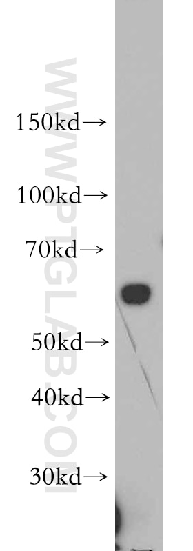 HEK-293 cells were subjected to SDS PAGE followed by western blot with 20625-1-AP(SLC39A4 Antibody) at dilution of 1:1500 SLC39A4 western blot WB 20625-1-AP SLC39A4 Antibody AEZ; FLJ20327; MGC74741; ZIP4