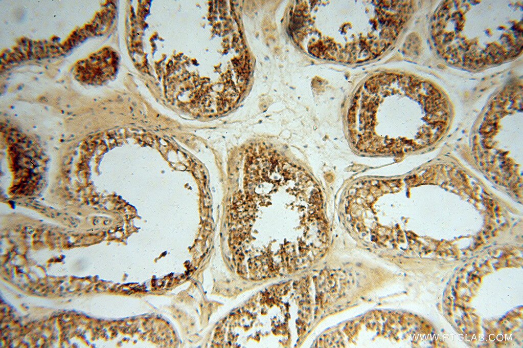 SLC3A2 IHC Immunohistochemical 15193-1-AP SLC3A2 Antibody 4F2; 4F2HC; 4T2HC; CD98; CD98HC; MDU1; NACAE