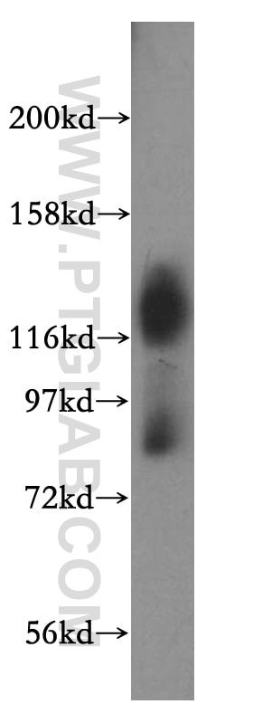 SLC3A2 western blot WB 15193-1-AP SLC3A2 Antibody 4F2; 4F2HC; 4T2HC; CD98; CD98HC; MDU1; NACAE