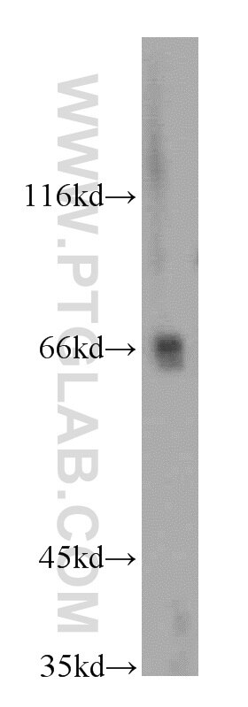 SLC5A8 western blot WB 21433-1-AP SLC5A8 Antibody AIT; MGC125354; SMCT; SMCT1