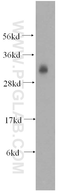 mouse testis tissue were subjected to SDS PAGE followed by western blot with 13315-1-AP(SLD5 Antibody) at dilution of 1:600 SLD5 western blot WB 13315-1-AP SLD5 Antibody MGC14799; SLD5