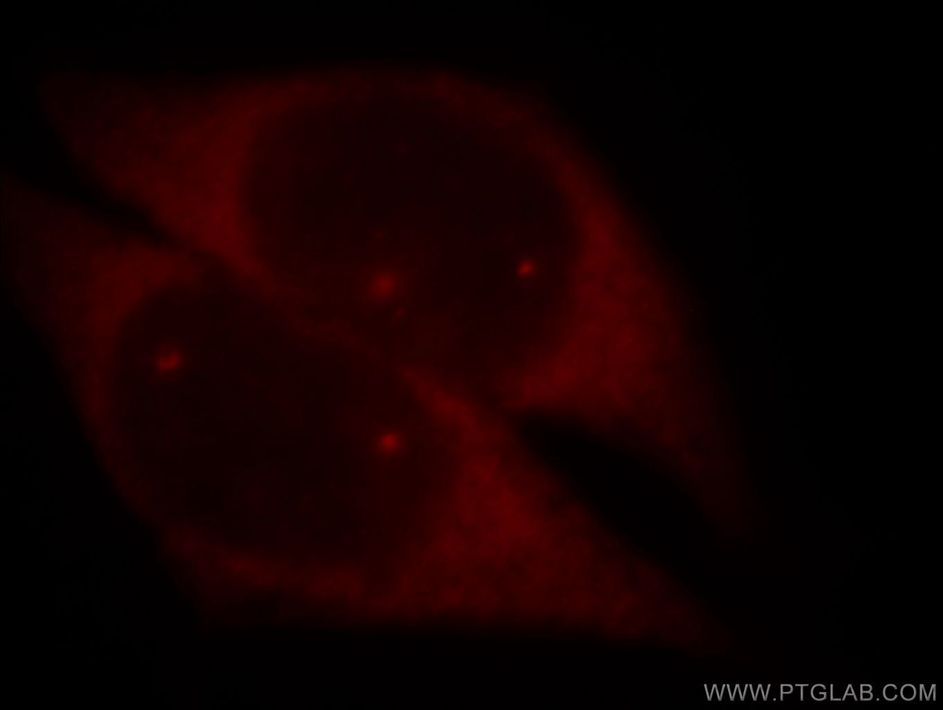 SMN2 Immunofluorescence IF 11708-1-AP SMN2 Antibody BCD541; C-BCD541; FLJ76644; MGC20996; MGC5208; SMNC