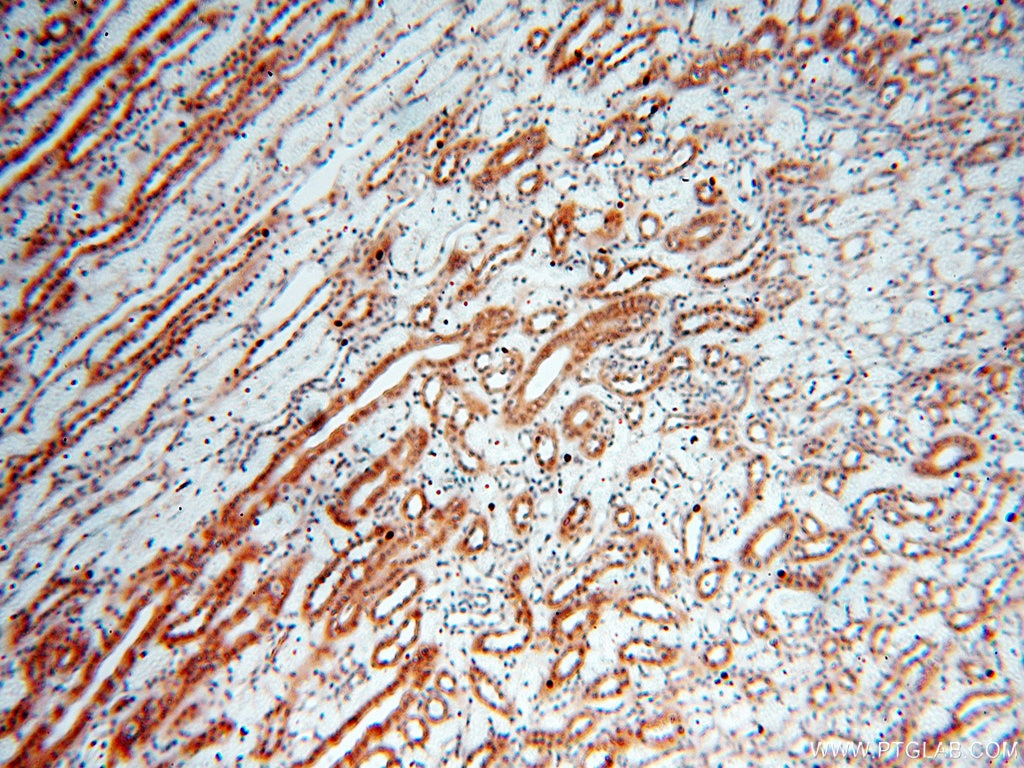 SMN2 IHC Immunohistochemical 11708-1-AP SMN2 Antibody BCD541; C-BCD541; FLJ76644; MGC20996; MGC5208; SMNC