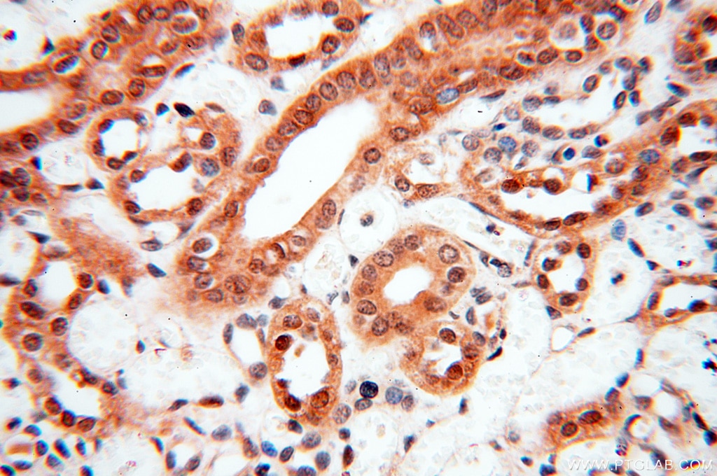 SMN2 IHC Immunohistochemical 11708-1-AP SMN2 Antibody BCD541; C-BCD541; FLJ76644; MGC20996; MGC5208; SMNC