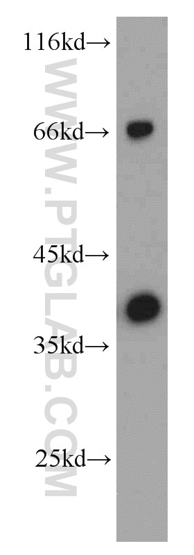 SMN2 western blot WB 11708-1-AP SMN2 Antibody BCD541; C-BCD541; FLJ76644; MGC20996; MGC5208; SMNC