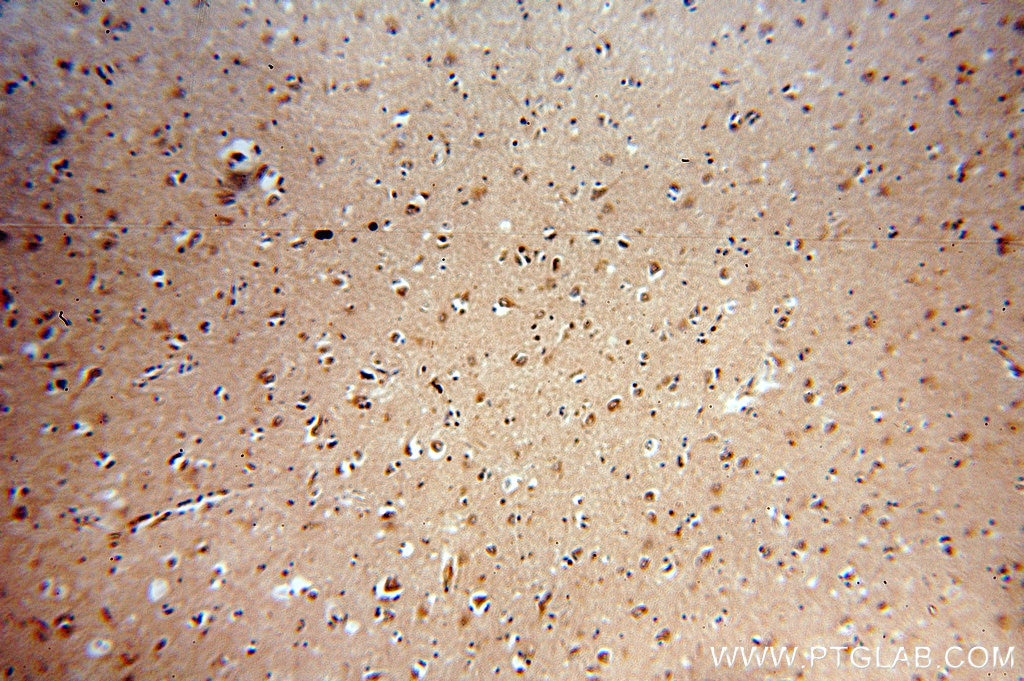 SMN2 IHC Immunohistochemical 60154-1-Ig SMN2 Antibody SMN2;BCD541;C-BCD541;FLJ76644;MGC20996;MGC5208;SMNC ;SMN1,SMN
