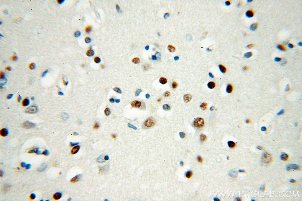 SMN2 IHC Immunohistochemical 60154-1-Ig SMN2 Antibody SMN2;BCD541;C-BCD541;FLJ76644;MGC20996;MGC5208;SMNC ;SMN1,SMN