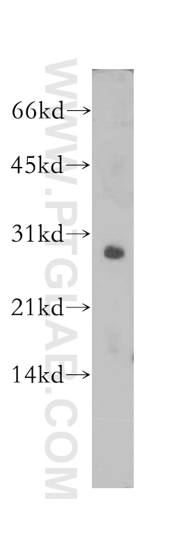 SNAI1 western blot WB 13099-1-AP SNAI1 Antibody SLUGH2; SNA; SNAH; dJ710H13.1