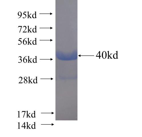 SNCA fusion protein ag1285 SDS-PAGE