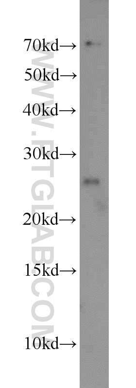 SNRPB western blot WB 16807-1-AP SNRPB Antibody COD; SNRPB1; SmB/SmB'; snRNP-B
