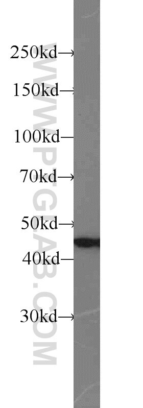mouse brain tissue were subjected to SDS PAGE followed by western blot with 10114-1-AP(SNX6 Antibody) at dilution of 1:600 SNX6 western blot WB 10114-1-AP SNX6 Antibody MGC3157; MSTP010; TFAF2