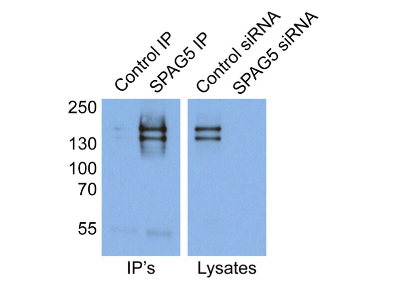 SPAG5 IP 14726-1-AP SPAG5 Antibody DEEPEST; MAP126; hMAP126