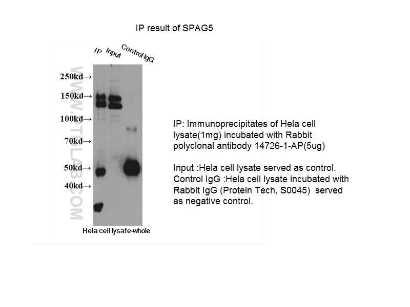 SPAG5 IP 14726-1-AP SPAG5 Antibody DEEPEST; MAP126; hMAP126