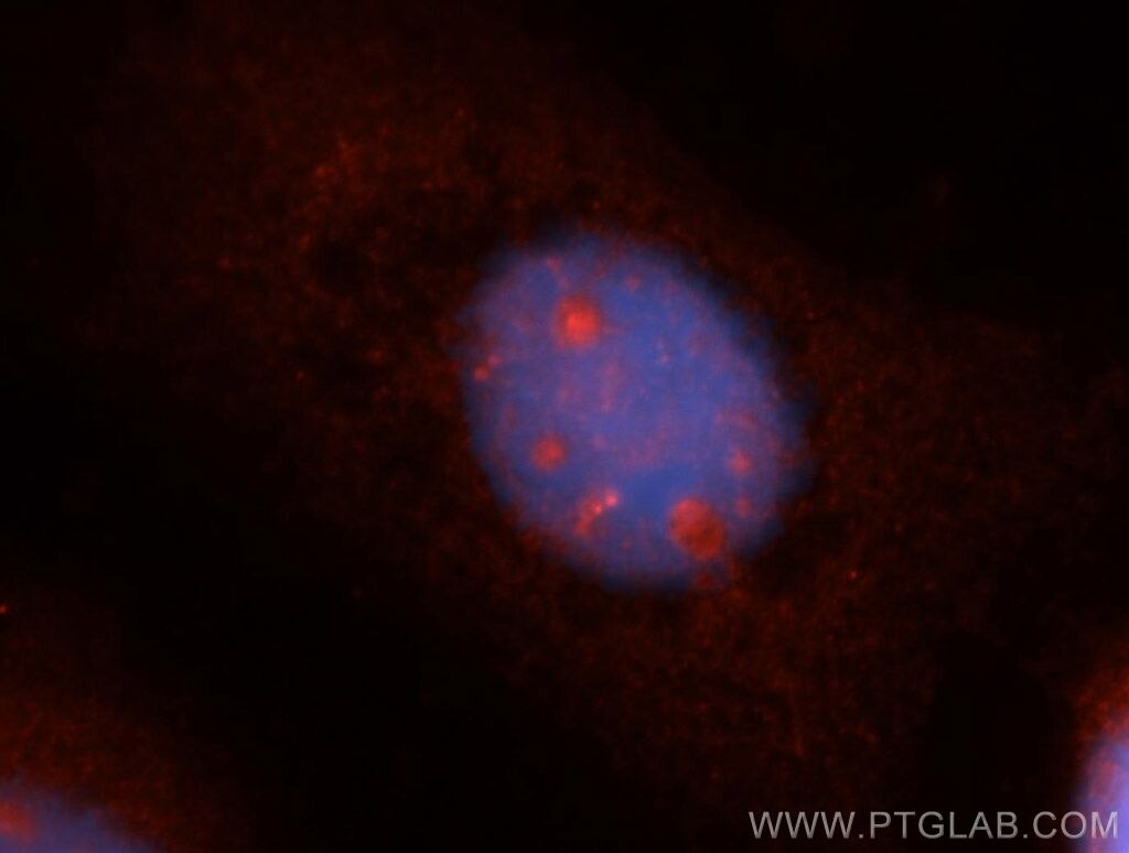 SPAG5 Immunofluorescence IF 14726-1-AP SPAG5 Antibody DEEPEST; MAP126; hMAP126