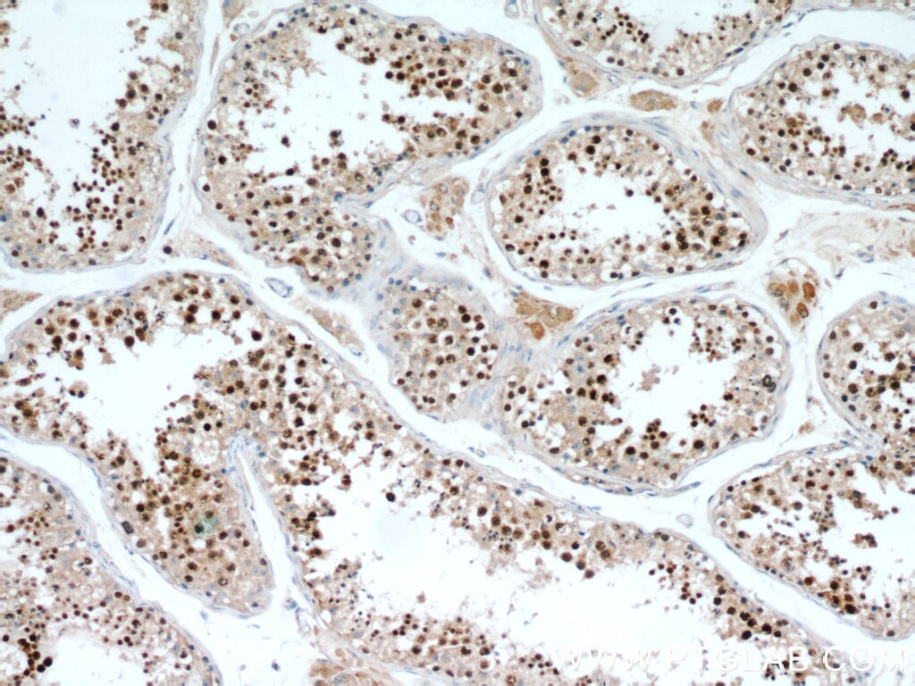 SPAG5 IHC Immunohistochemical 14726-1-AP SPAG5 Antibody DEEPEST; MAP126; hMAP126