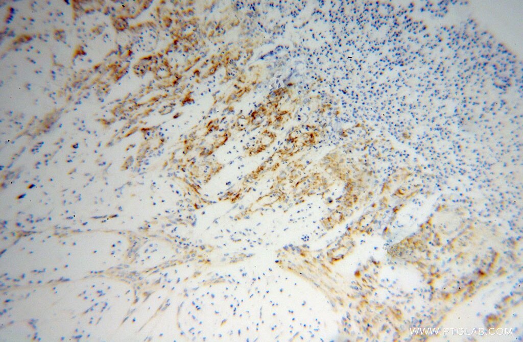 SPARC IHC Immunohistochemical 15274-1-AP SPARC Antibody SPARC;ON ;Osteonectin; BM-40