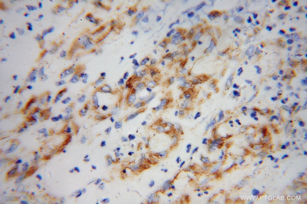 SPARC IHC Immunohistochemical 15274-1-AP SPARC Antibody SPARC;ON ;Osteonectin; BM-40