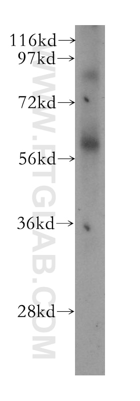 human lung tissue were subjected to SDS PAGE followed by western blot with 11000-1-AP(SPATA2 Antibody) at dilution of 1:800 SPATA2 western blot WB 11000-1-AP SPATA2 Antibody FLJ13167; KIAA0757; PD1; tamo