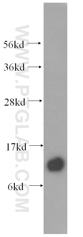 human skin tissue were subjected to SDS PAGE followed by western blot with 11847-1-AP(SPCS1 Antibody) at dilution of 1:1000 SPCS1 western blot WB 11847-1-AP SPCS1 Antibody HSPC033; SPC1; SPC12; YJR010C-A