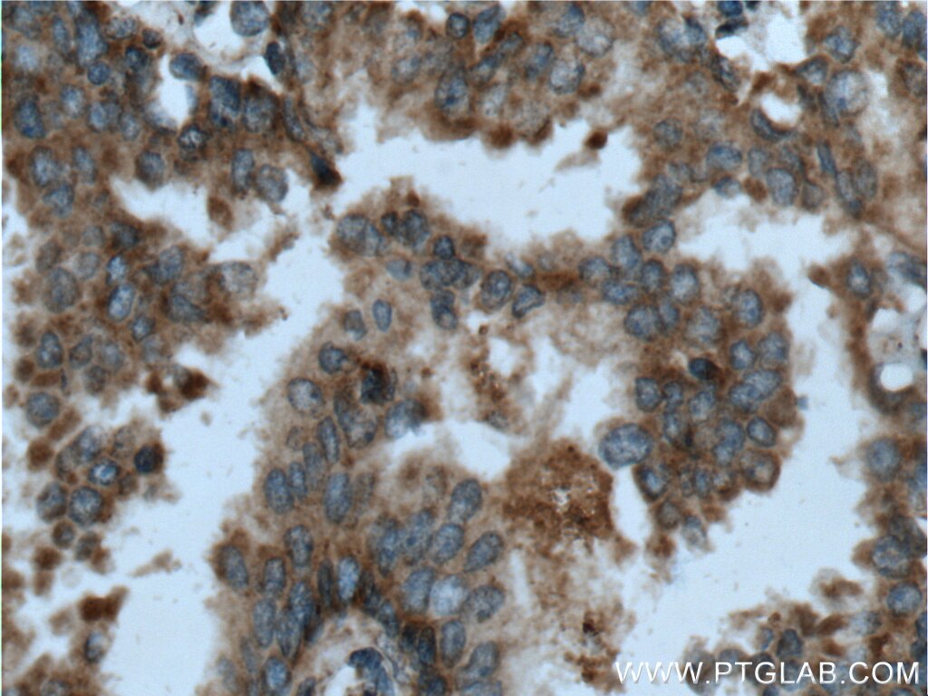 hai 1 antibody 15036 1 ap proteintech