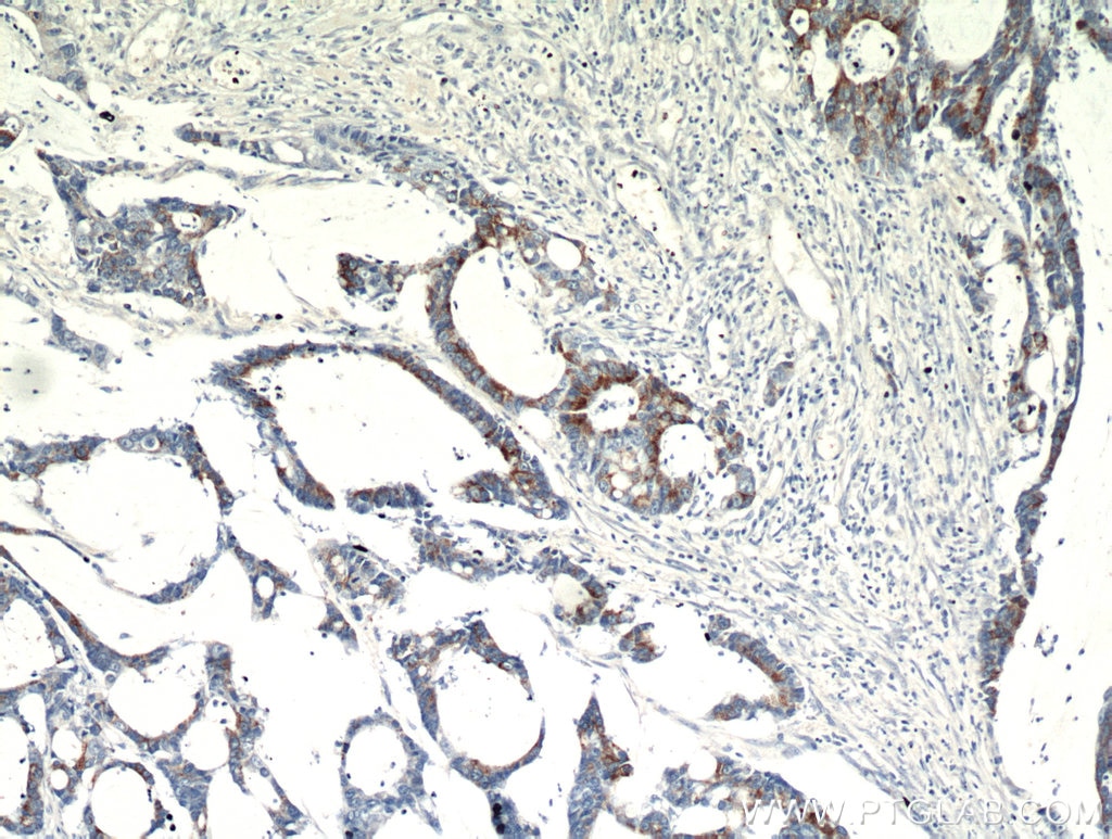 SPRR3 IHC Immunohistochemical 11742-1-AP SPRR3 Antibody 