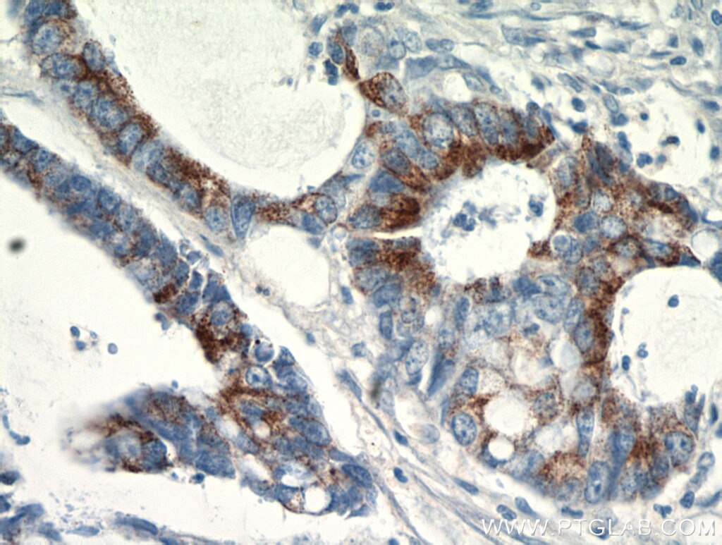 SPRR3 IHC Immunohistochemical 11742-1-AP SPRR3 Antibody 