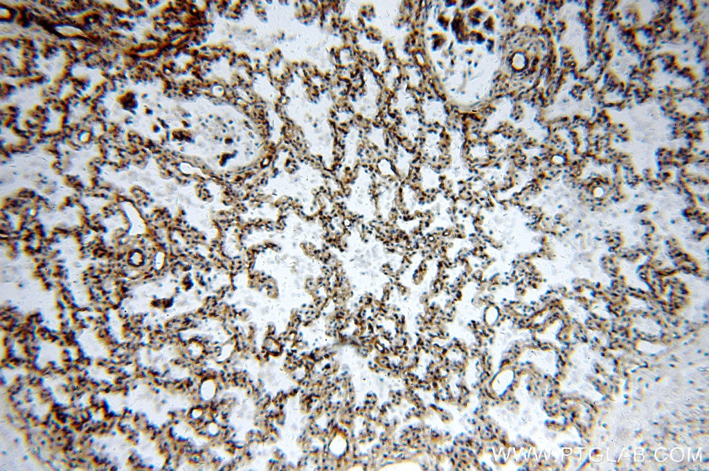 SPTBN1-Specific IHC Immunohistochemical 19722-1-AP SPTBN1-Specific Antibody ELF; SPTB2; betaSpII