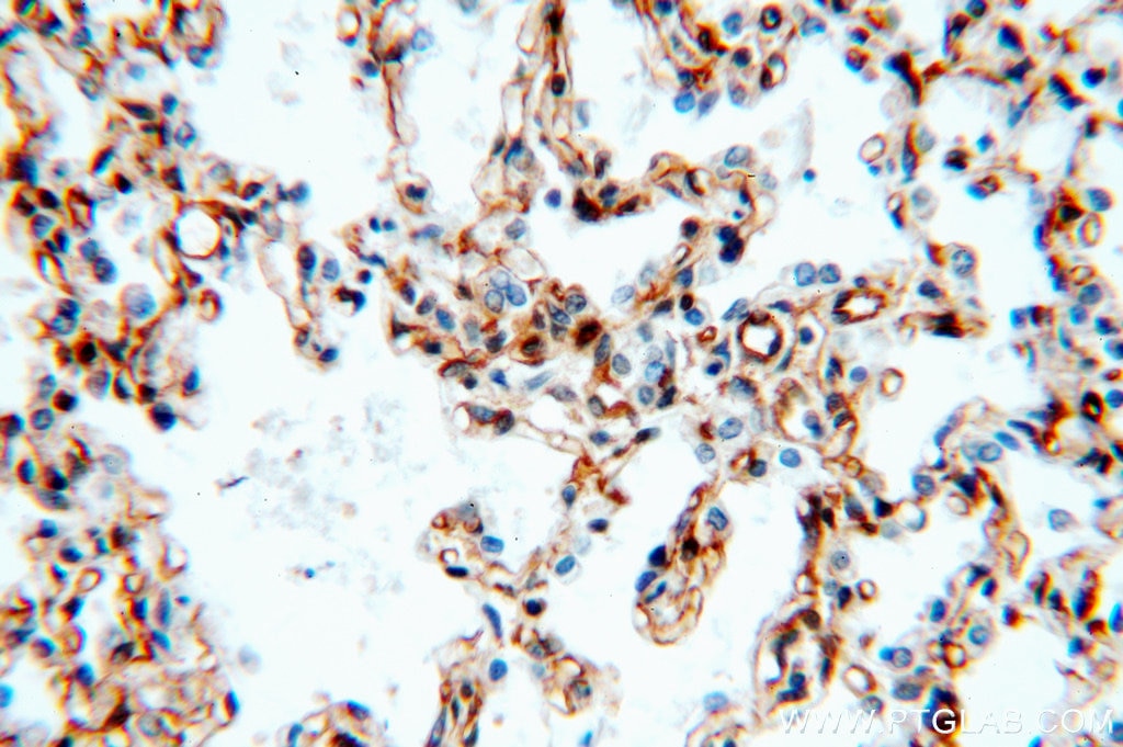 SPTBN1-Specific IHC Immunohistochemical 19722-1-AP SPTBN1-Specific Antibody ELF; SPTB2; betaSpII
