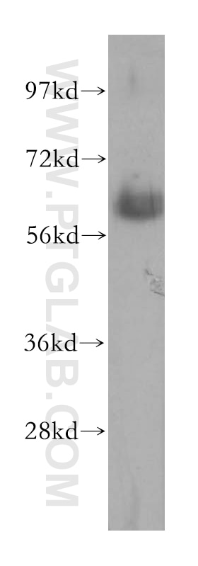 SPTLC2 western blot WB 51012-2-AP SPTLC2 Antibody KIAA0526; LCB2; SPT2
