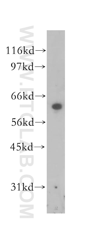 SQLE western blot WB 12544-1-AP SQLE Antibody FLJ30795