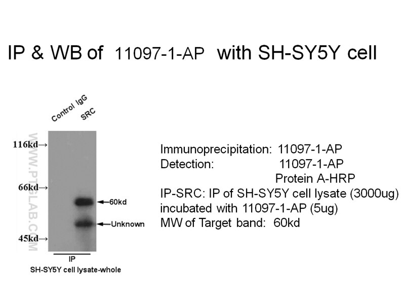 SRC IP 11097-1-AP SRC Antibody ASV; SRC1; c-SRC; p60-Src