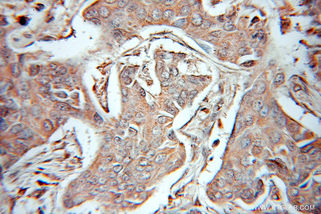 SRC IHC Immunohistochemical 11097-1-AP SRC Antibody ASV; SRC1; c-SRC; p60-Src