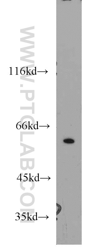 SRC western blot WB 11097-1-AP SRC Antibody ASV; SRC1; c-SRC; p60-Src