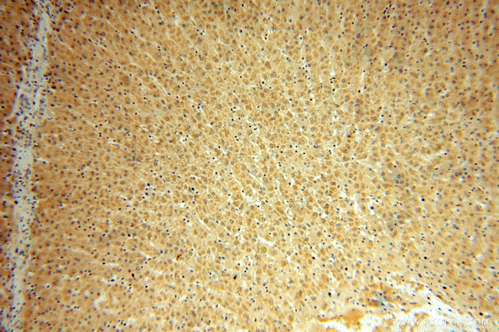 SRI IHC Immunohistochemical 16471-1-AP SRI Antibody FLJ26259; SCN