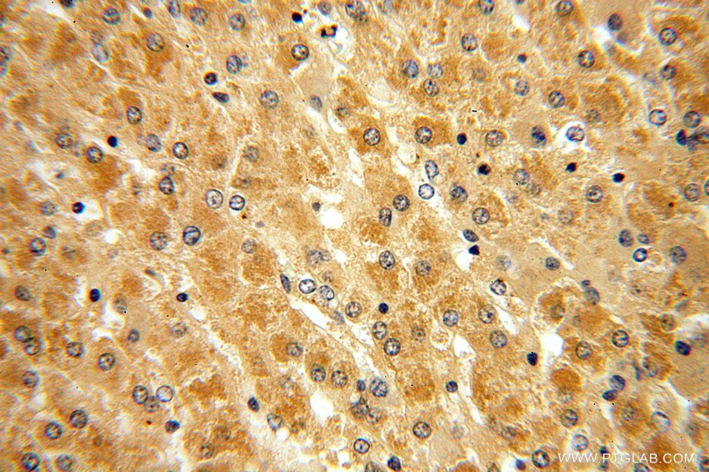 SRI IHC Immunohistochemical 16471-1-AP SRI Antibody FLJ26259; SCN