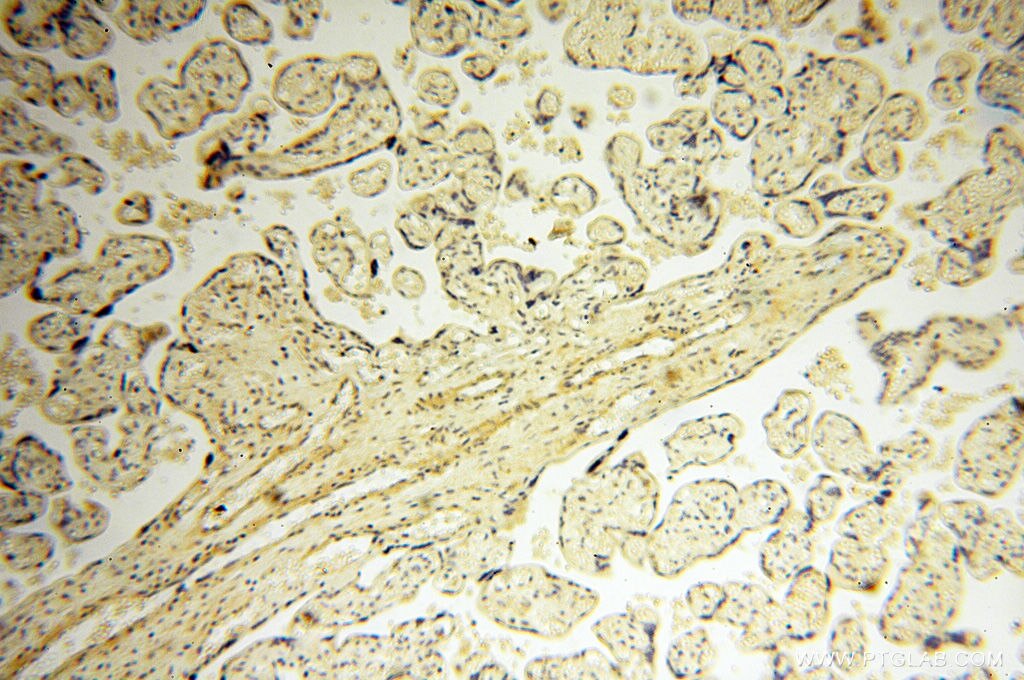 SRPX2 IHC Immunohistochemical 11845-1-AP SRPX2 Antibody BPP; CBPS; PMGX; RESDX; SRPUL