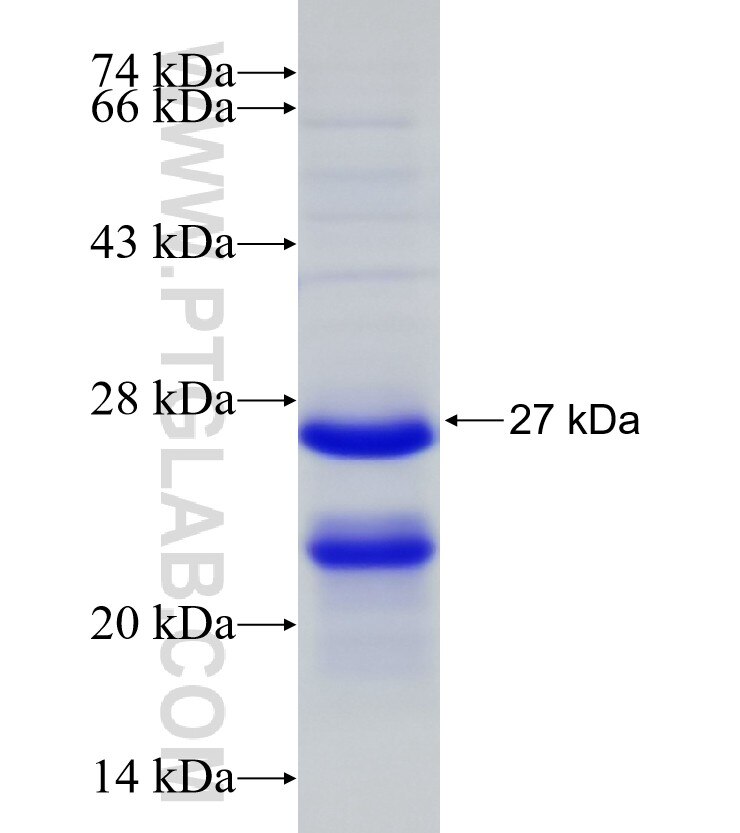 SSSCA1 fusion protein ag16783 SDS-PAGE