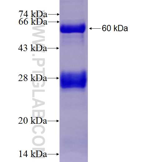 ST6GAL1 fusion protein ag5705 SDS-PAGE
