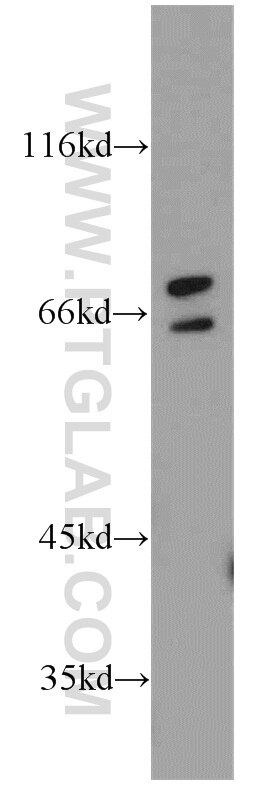 ST6GALNAC1 western blot WB 15363-1-AP ST6GALNAC1 Antibody HSY11339; SIAT7A; ST6GalNAcI; STYI