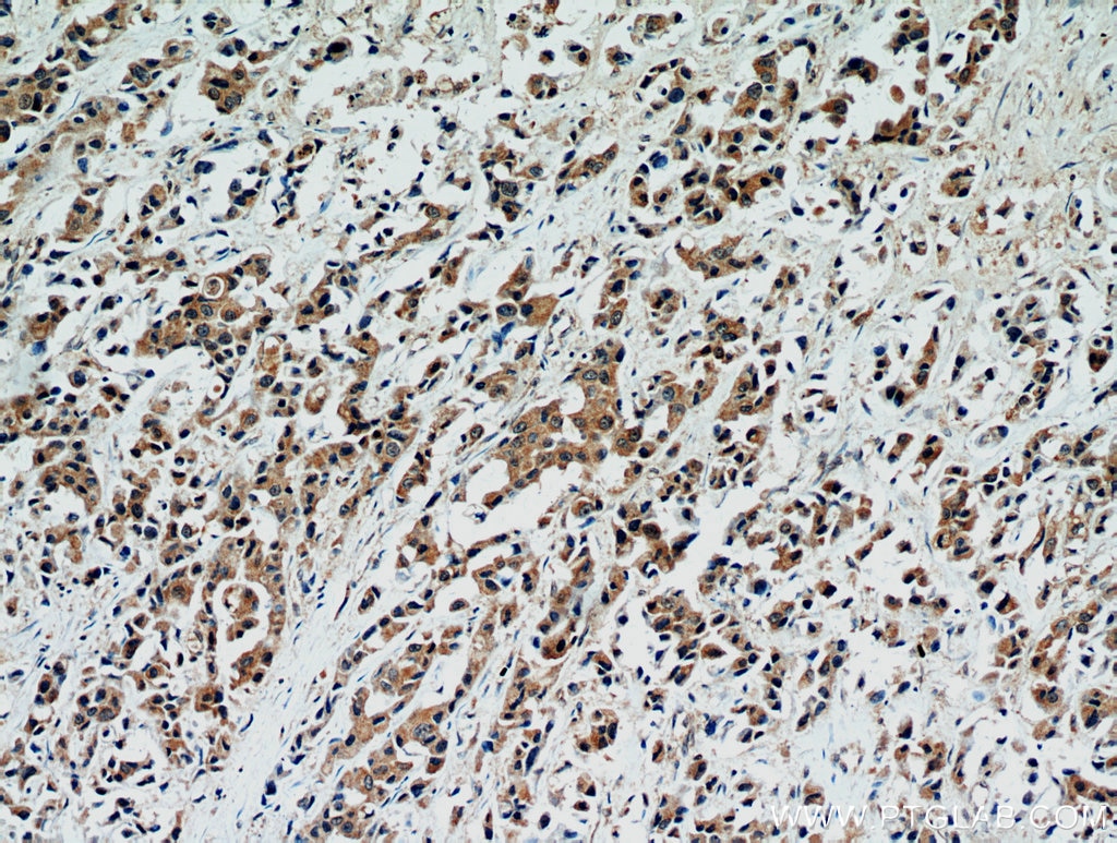 STAT2 IHC Immunohistochemical 16674-1-AP STAT2 Antibody ISGF-3; MGC59816; P113; STAT113